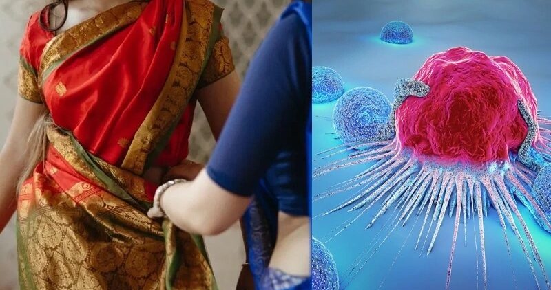 Saree Cancer