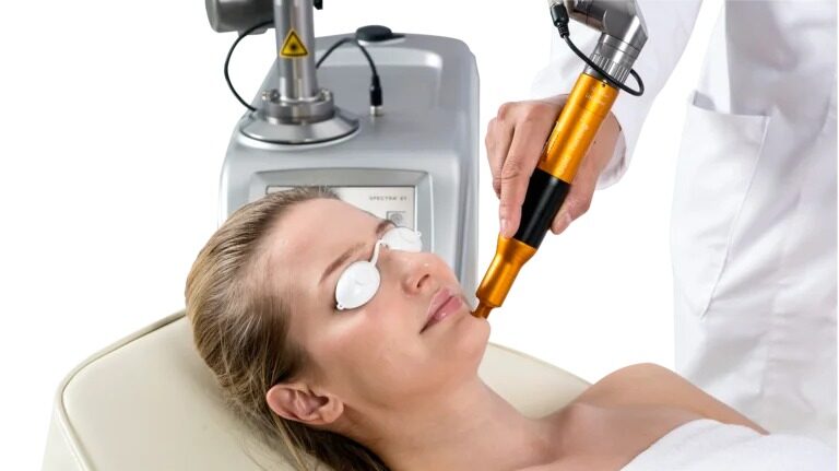 Spectra XT Gold Toning