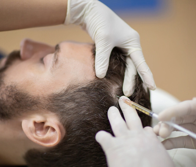 hair loss treatment